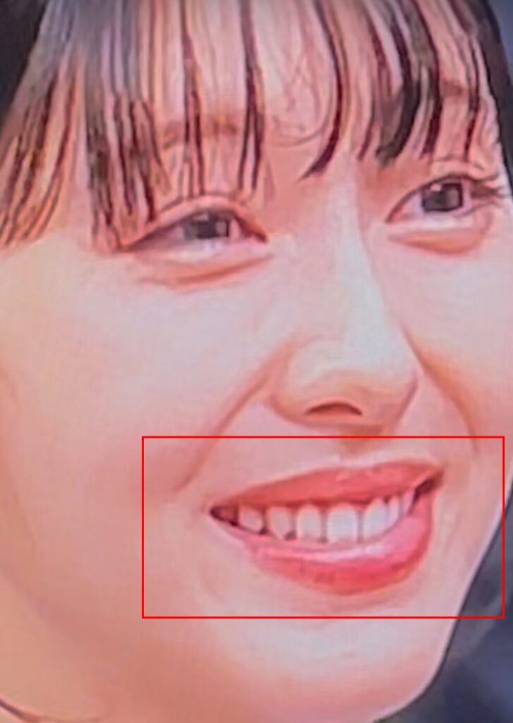 森香澄の24時間テレビで歯が黄色い