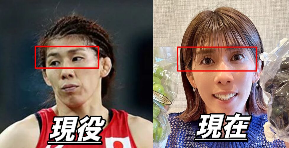 吉田沙保里比較画像