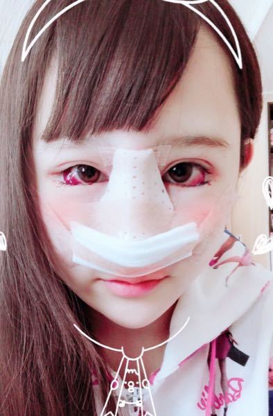 ゆりにゃさんのダウンタイム