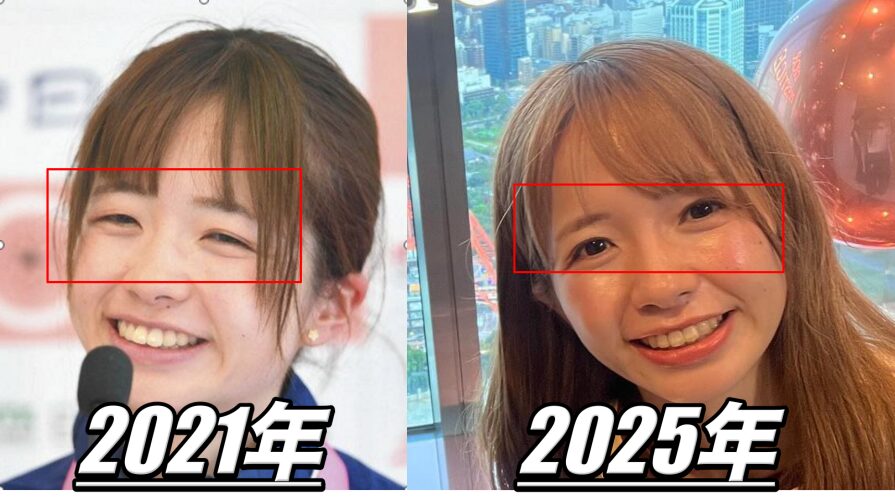 佐藤早也伽 目 整形の比較