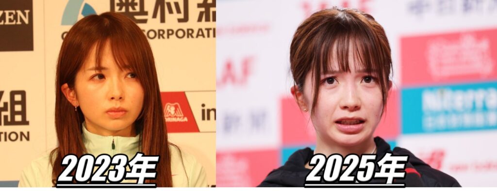 佐藤早也伽 目 整形の比較